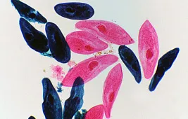 Инфузории под микроскопом