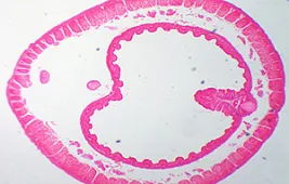 Как выглядит червяк под микроскопом